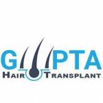 Gupta Hair Transplant in Ludhiana