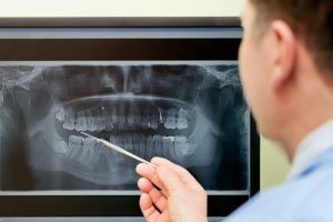 Dental X-Rays | Digital vs Traditional | Cherry Creek Dental Spa