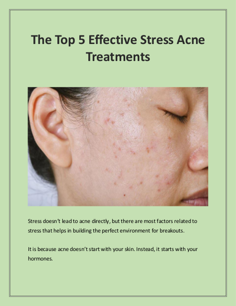 The Top 5 Effective Stress Acne Treatments | edocr