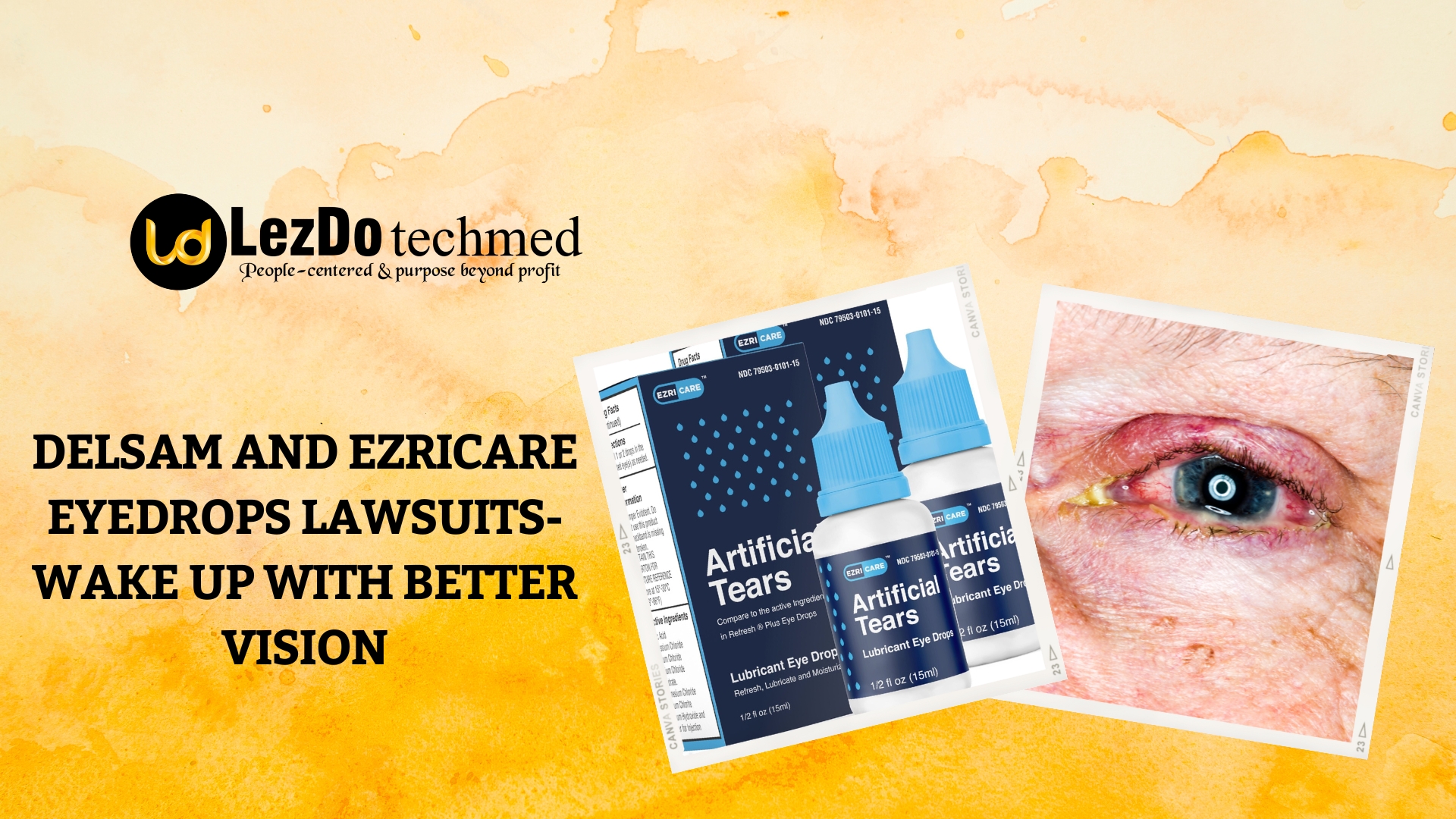 Delsam and EzriCare Eyedrops Lawsuits-Wake Up with Better Vision