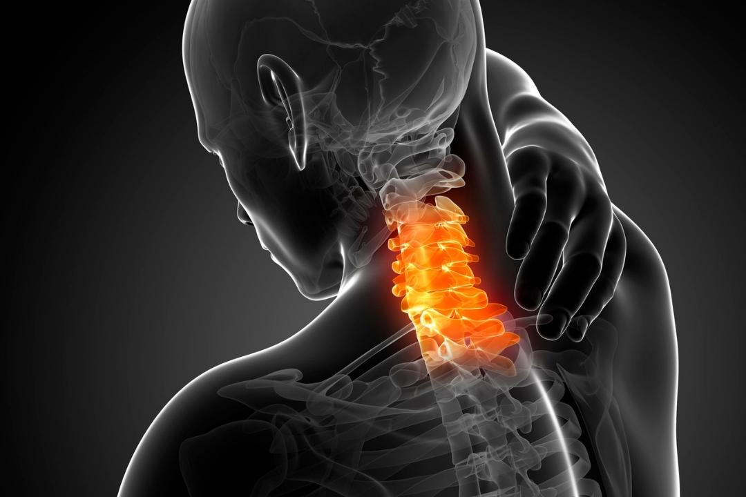 Cervical Degenerative Disc Disease: How to Manage Your Wear & Tear?