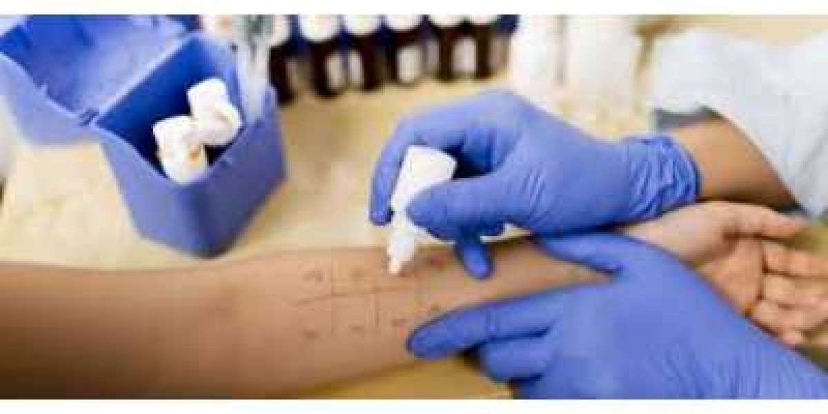 Allergy Diagnostics Market Size Growing at 10.7% CAGR Set to Reach USD 8,873.68 Million By 2028