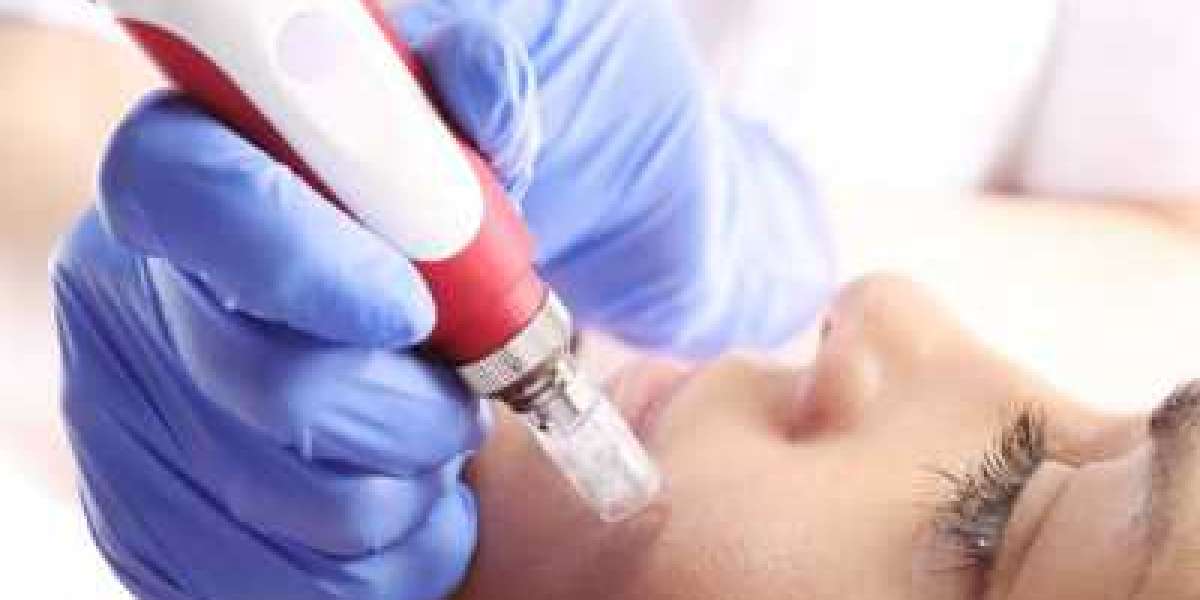 Medical Aesthetics Market Size Growing at 11.3% CAGR Set to Reach USD 22.14 Billion By 2028