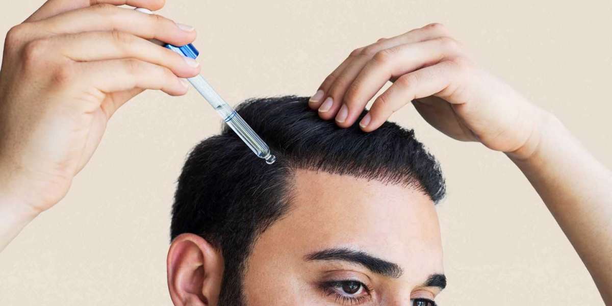 Alopecia Treatment Market Demand, Supply, Growth Factors, Latest Rising Trend and Forecast to 2027