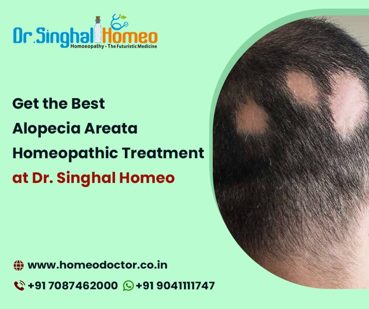 Alopecia Areata Homeopathic Treatment - A Time-tested & Proven Option For Great Hair Health - Alternative Medicine - OtherArticles.com