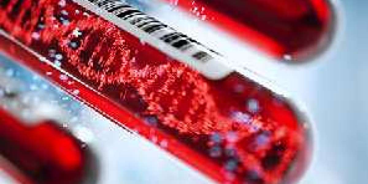 Liquid Biopsy Market Size Growing at 17.8% CAGR Set to Reach USD 10.9 Billion By 2028