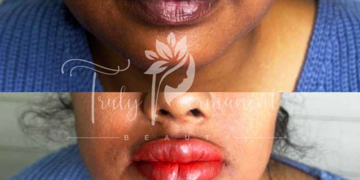 How to Lighten Dark Lips?