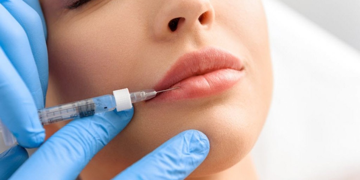 Use of Juvederm Lip Fillers and its Advantages