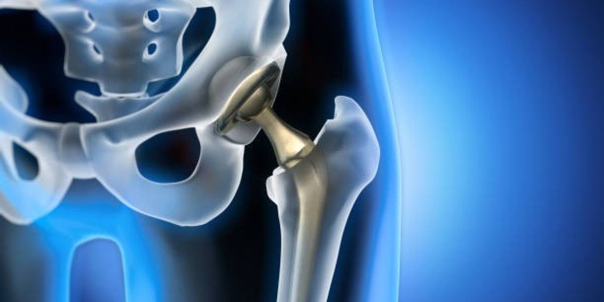 Global Hip Replacement Market Size to Reach USD 8.89 billion by 2028, At Growth Rate (CAGR) of 2.5%.