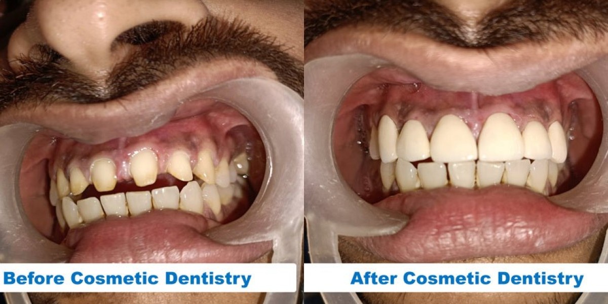 Is cosmetic dentistry helpful in smile design?