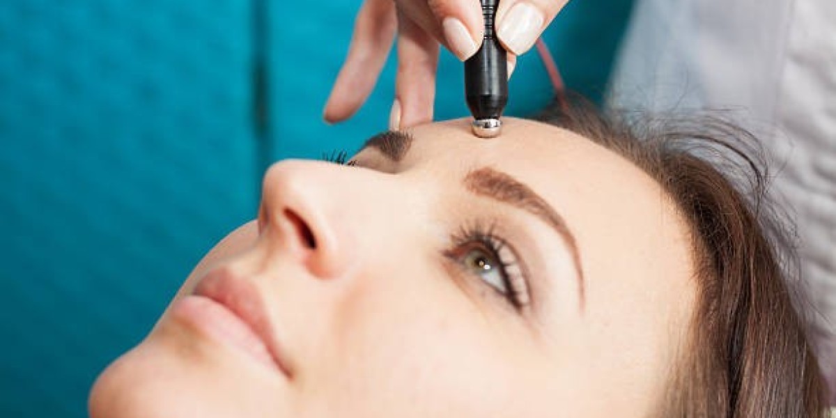 The Marvels of SkinPen Microneedling: A Comprehensive Guide