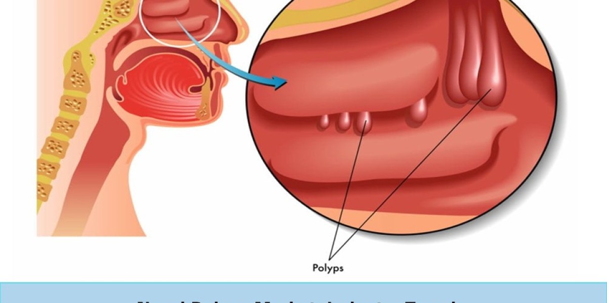 Nasal Polyps Market: Analysis of Epidemiology, Industry Trends, Size, Share, and Future Forecast (2023-2033)