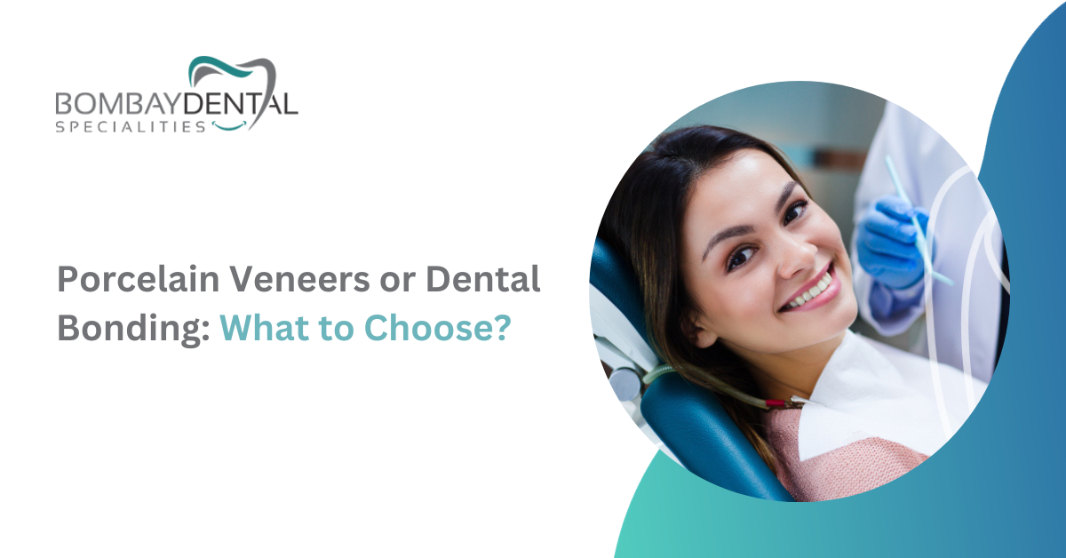 Porcelain Veneers or Dental Bonding: What to Choose? | Bombay Dental Specialities