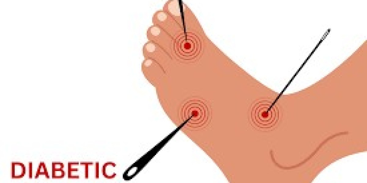 Diabetic Neuropathy Market: Epidemiology, Size, Share, Analysis and Forecast till (2023-2033)