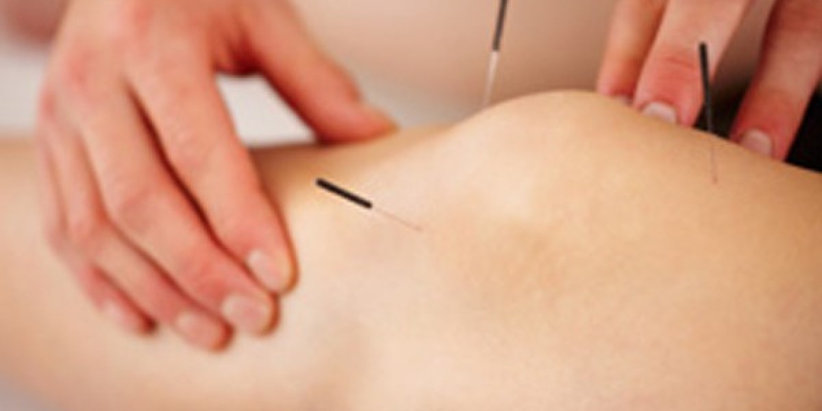 Acupuncture and its benefits