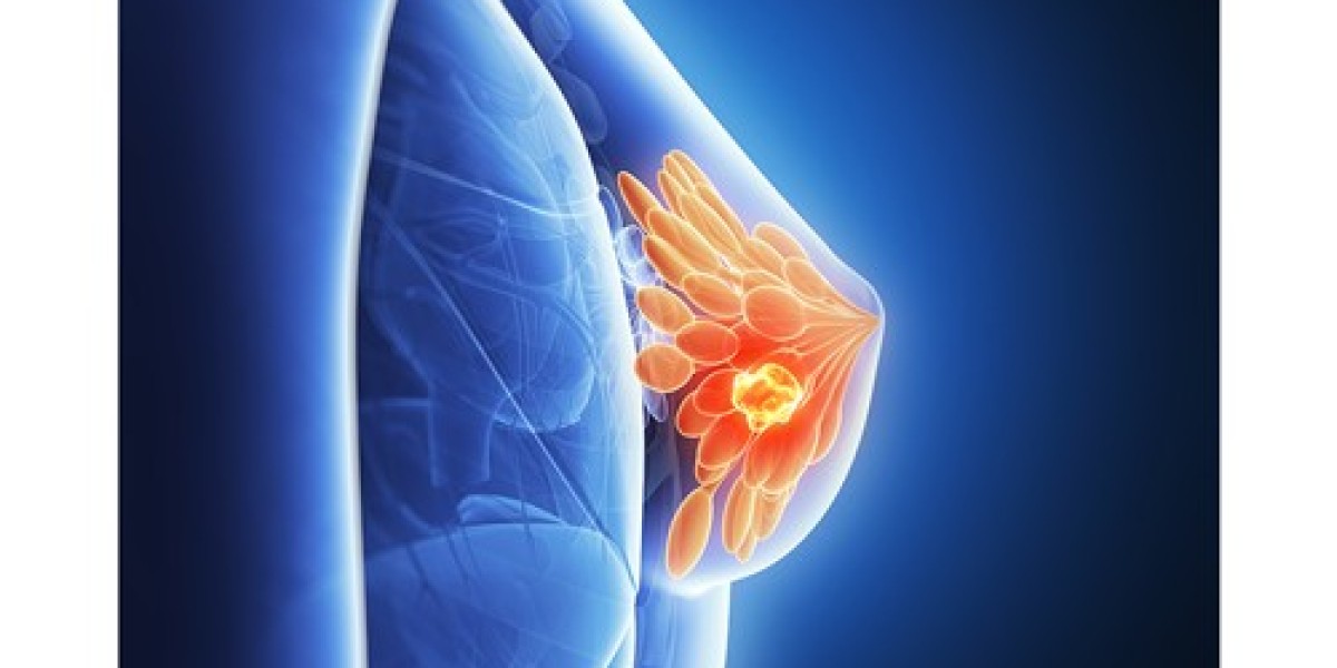 2024, Metastatic HER2-Positive Breast Cancer Market | Industry Analysis Till 2034