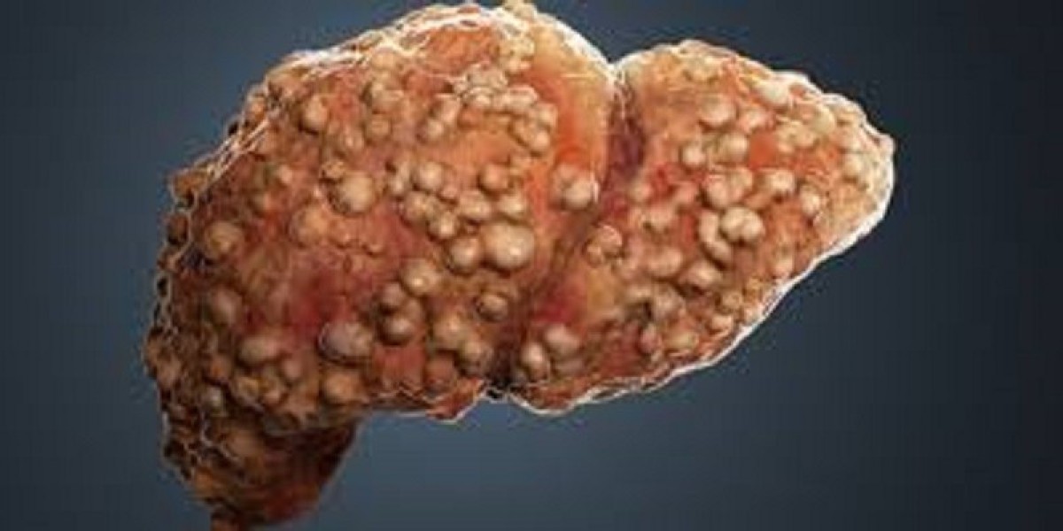 Liver Fibrosis Market Share, Epidemiology, Analysis & Trends 2023-2033