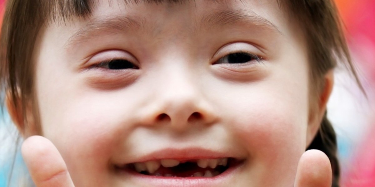 Down Syndrome Market: Epidemiology, Trends, Demand, Share, Size (2023-2033)