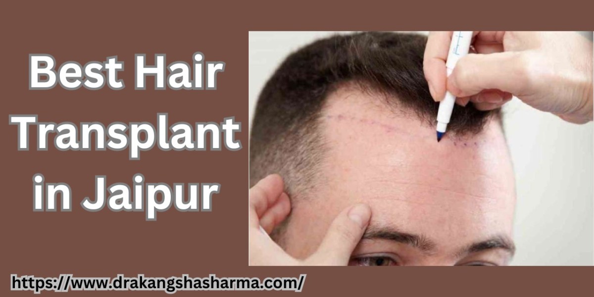 Can Dandruff & Dry Scalp Cancel Your Hair Transplant?