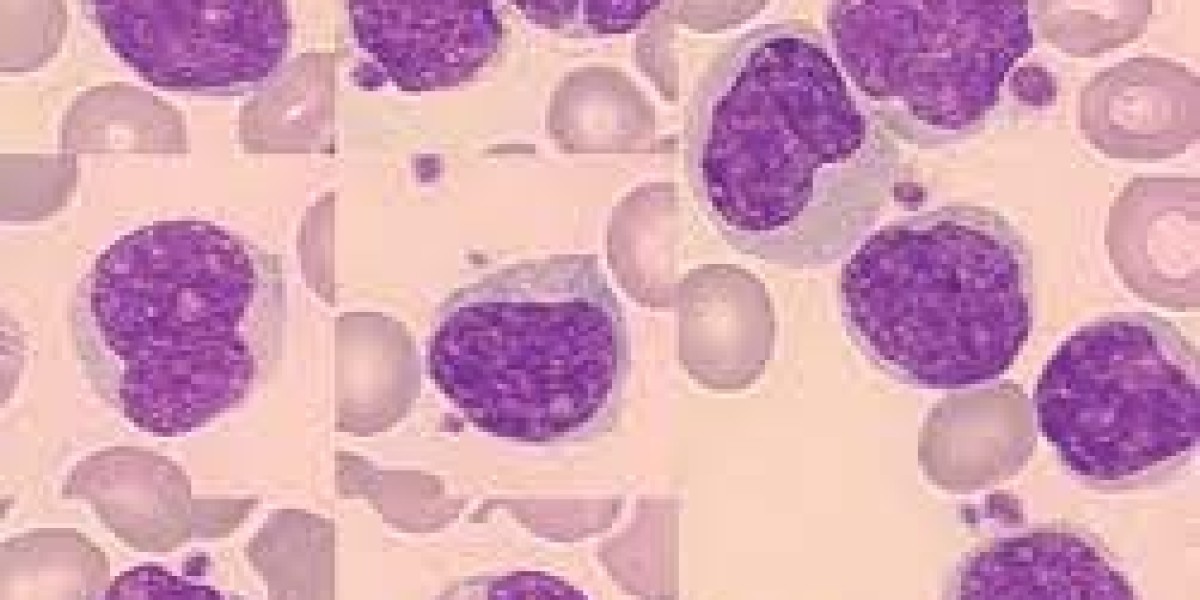Size and Share of Mantle Cell Lymphoma Market by 2034