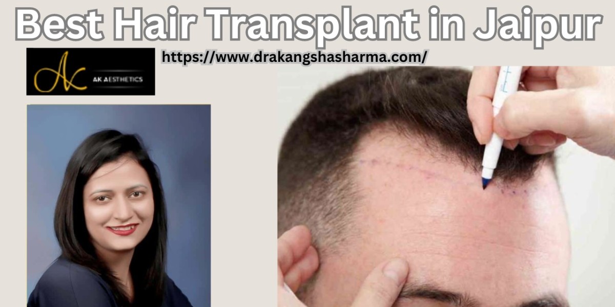 Hair Transplant For Traction Alopecia