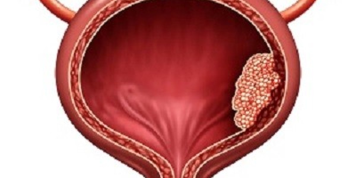 Size and Share of Bladder Cancer Market by 2034