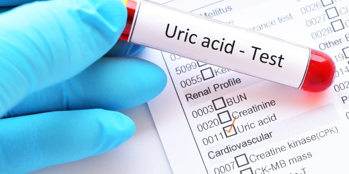Affordable Wellness: Exploring Uric Acid Test Prices for Comprehensive Health Monitoring
