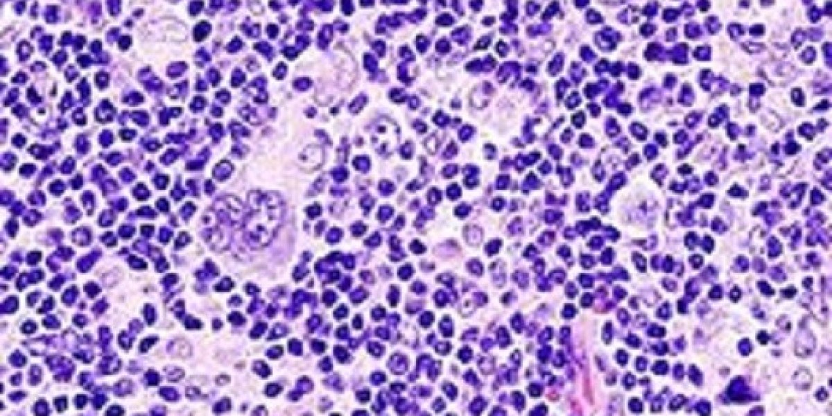 Hodgkin’s Lymphoma Market Report 2024: Epidemiology, Industry Trends, Size, Share and Forecast to 2034