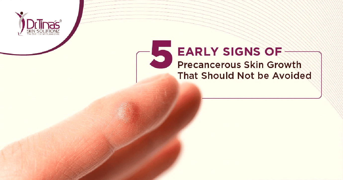 5 Early Signs of Precancerous Skin Growth That Should Not be Ignored - Skin Solutionz