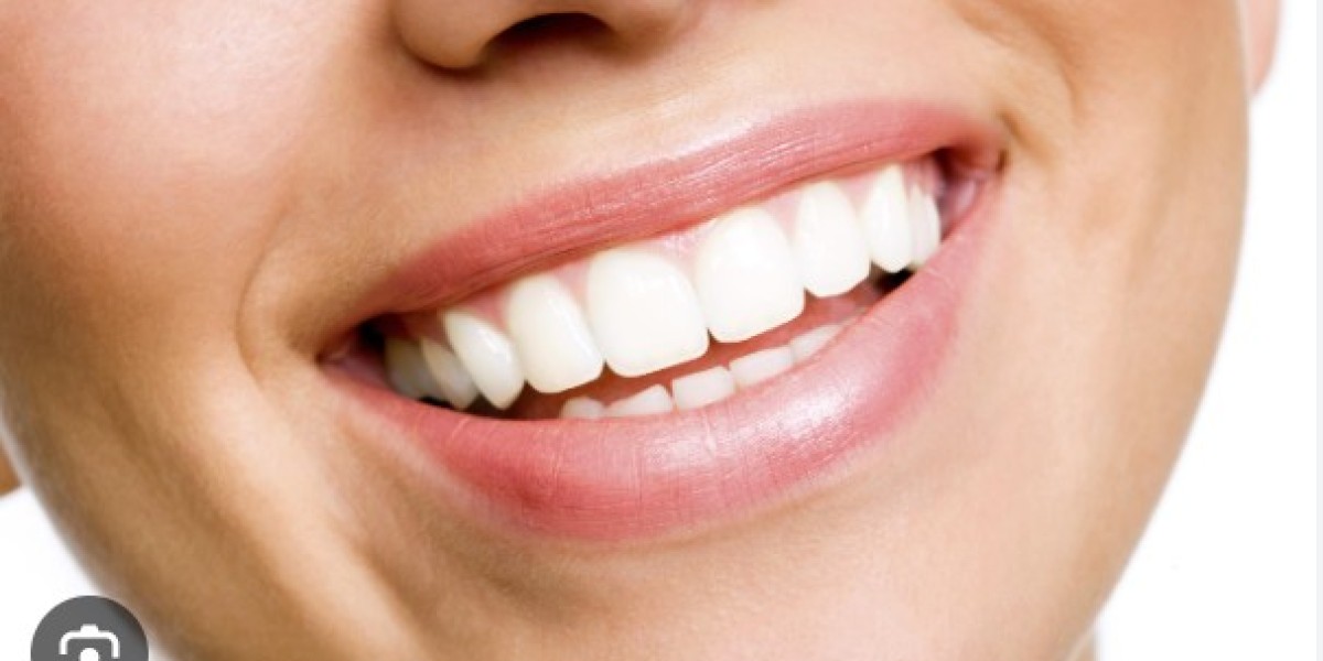The Bright Side of Smile: An Insight into Teeth Whitening