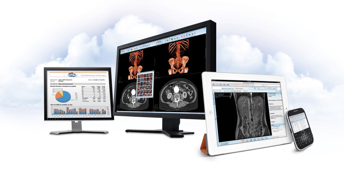 Precision Visualization: Optimizing Radiology with Advanced Monitor Technology
