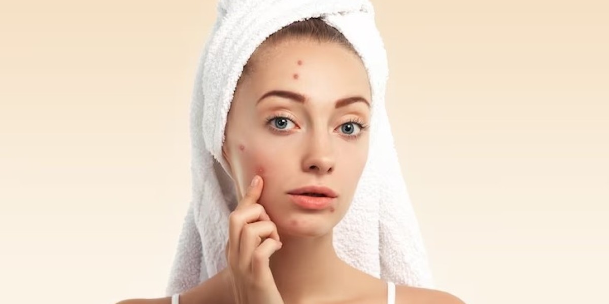 Achieve Clearer Skin: Effective Acne Scar Treatments to Reclaim Your Confidence