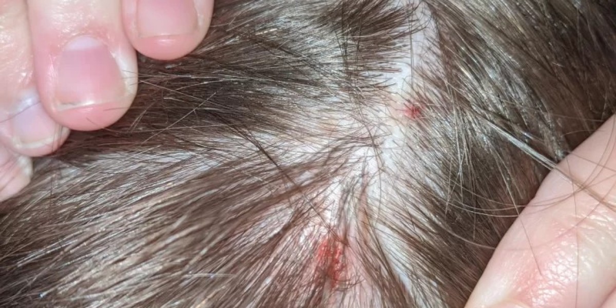 Why Is My Scalp Tender in One Spot? A Closer Look