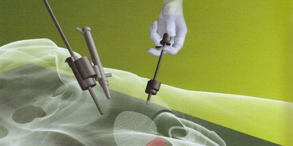 Laparoscopic Electrodes Industry: Global Market for Laparoscopic Electrodes is Booming