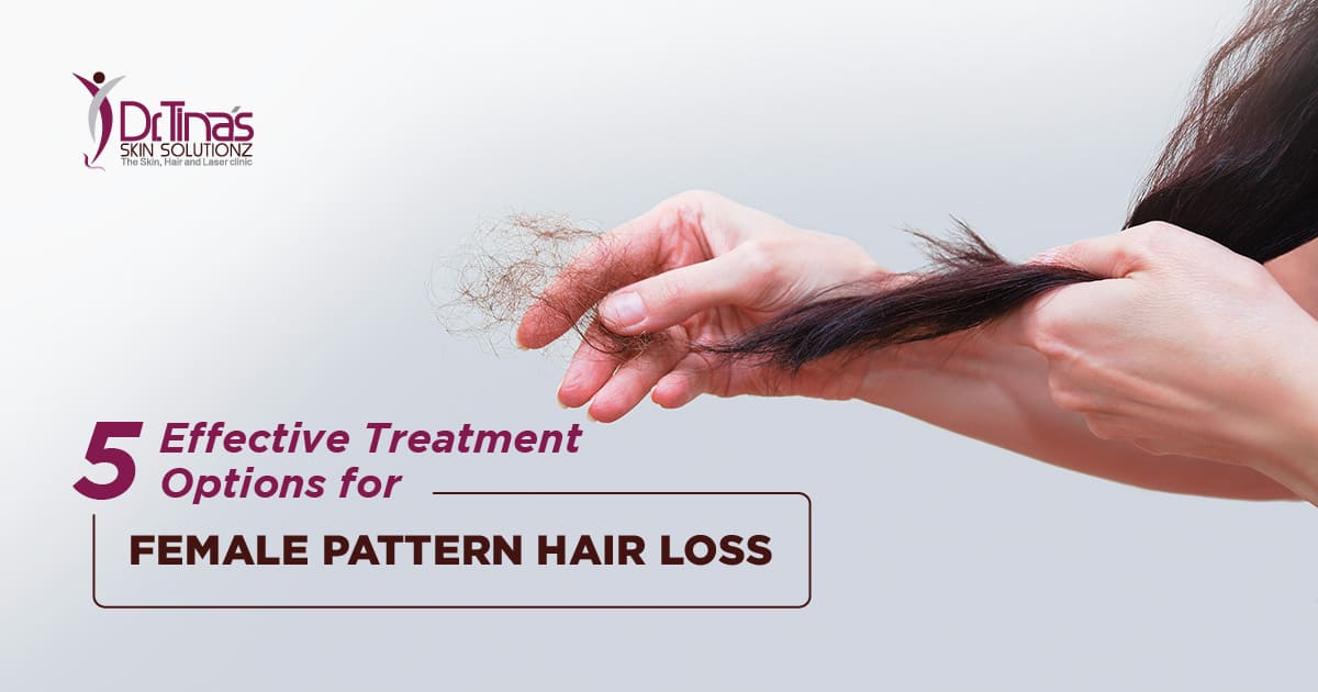 5 Effective Treatment Options for Female Pattern Hair Loss - Skin Solutionz