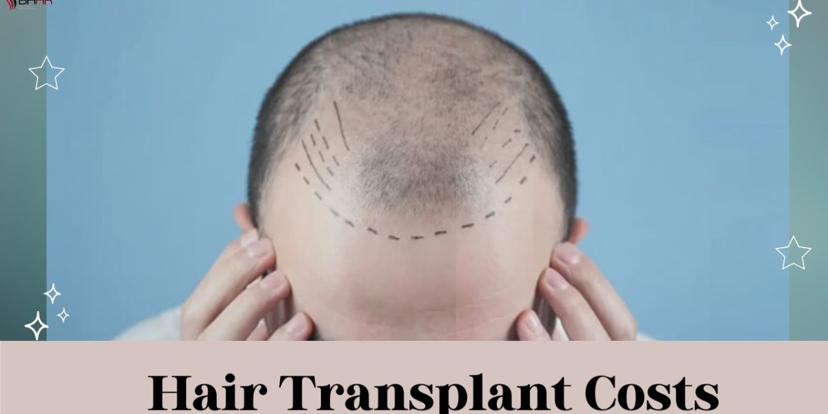 How to Compare Hair Transplant Costs Effectively