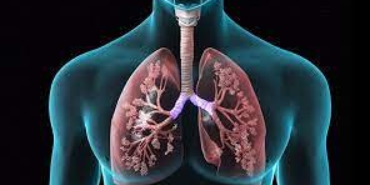 Chronic Obstructive Pulmonary Disease Market Research | 2024-2034