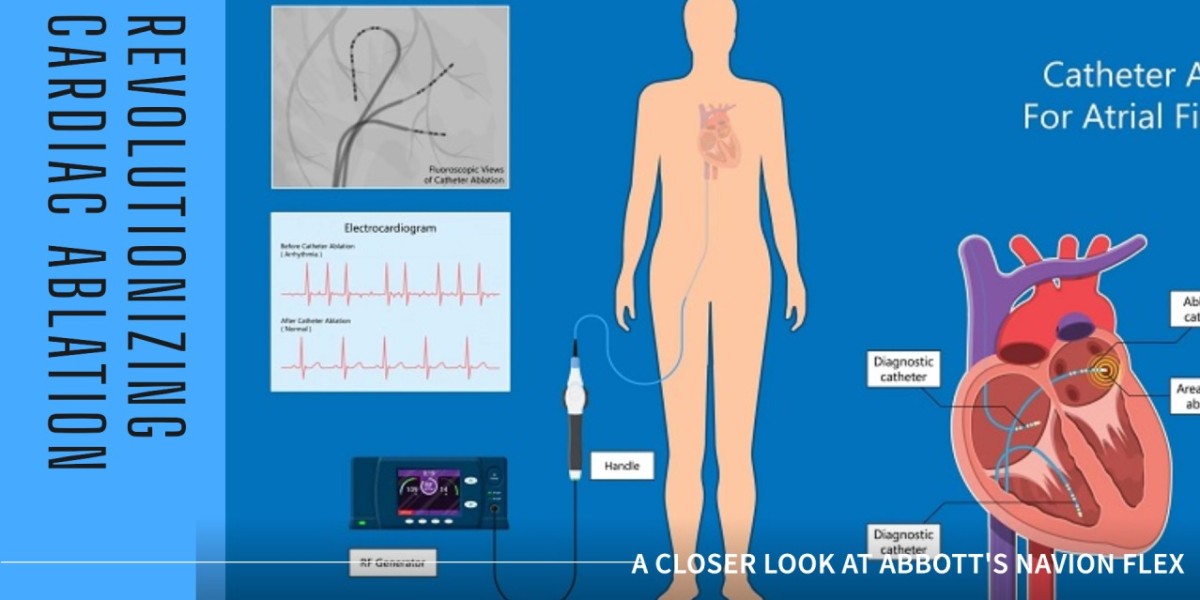 Minimally Invasive Cardiac Catheterization: BD, Terumo, and J&J Drive Innovation