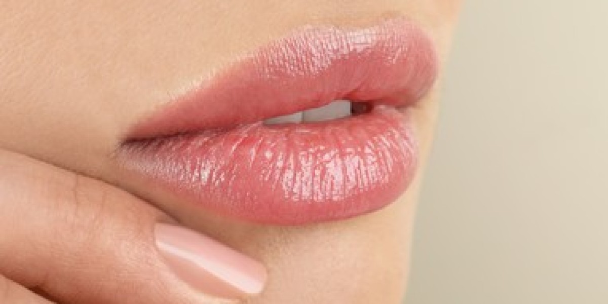 Define Your Smile: Juvederm Lip Transformations