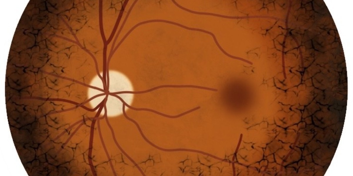 Retinitis Pigmentosa Market Report: Epidemiology, Trends and Forecast to (2024-2034)