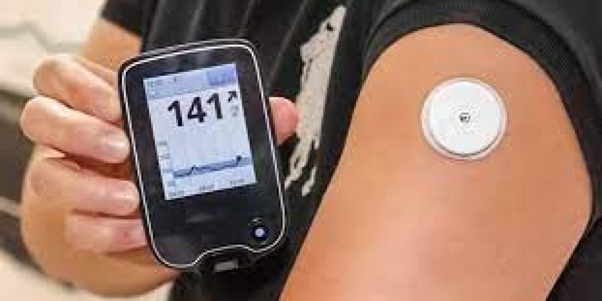 Non-Invasive Blood Glucose Monitoring Devices Market Size 2023 Top key Players and Analysis Report