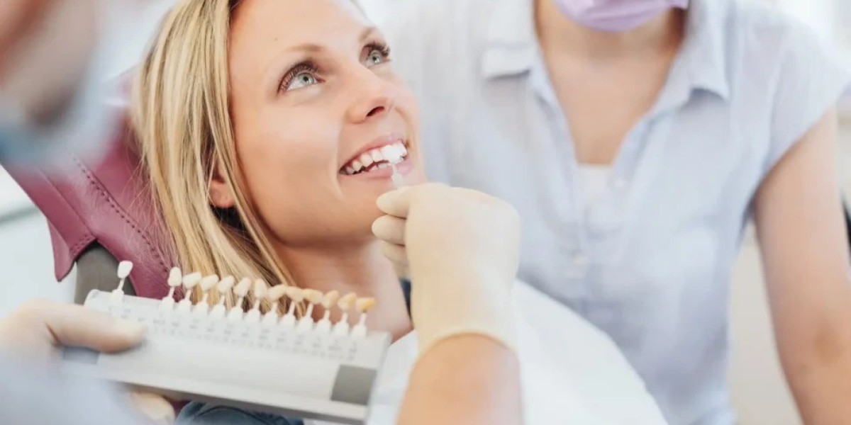 How Long Does Composite Veneers Last