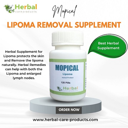 Mopical: The Lipoma Removal Supplement You Need to Know - Natural Health News