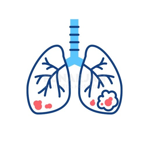 LungCancerTreatmentHospitals Hyderabad