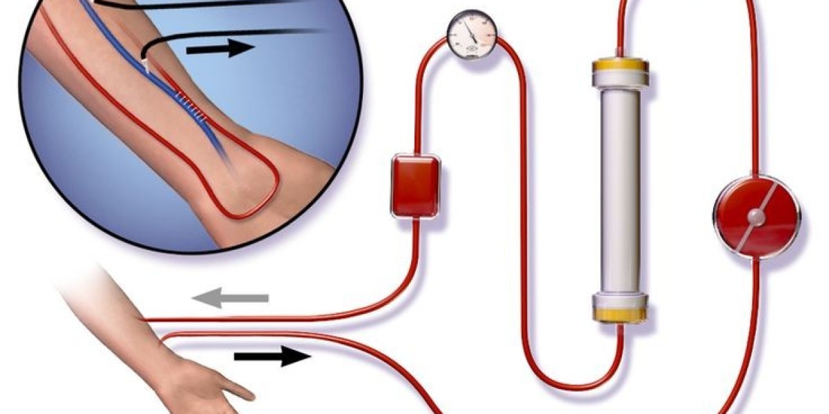 CryoLife’s Biological Grafts: Bringing Hope to Hemodialysis Patients with Enhanced Healing Solutions