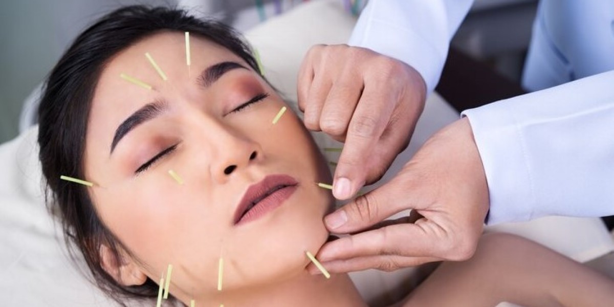 Discover the Benefits of Acupuncture Face Lift