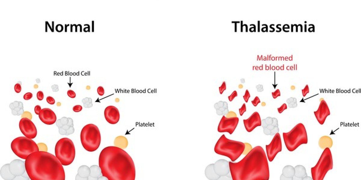 Thalassemia Market Share 2024 | Forecast till 2034