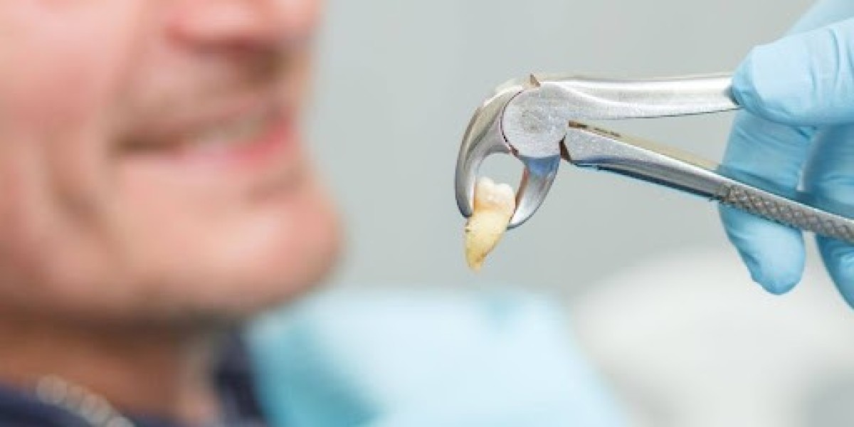 Wisdom Tooth Extraction - Everything You Need to Know