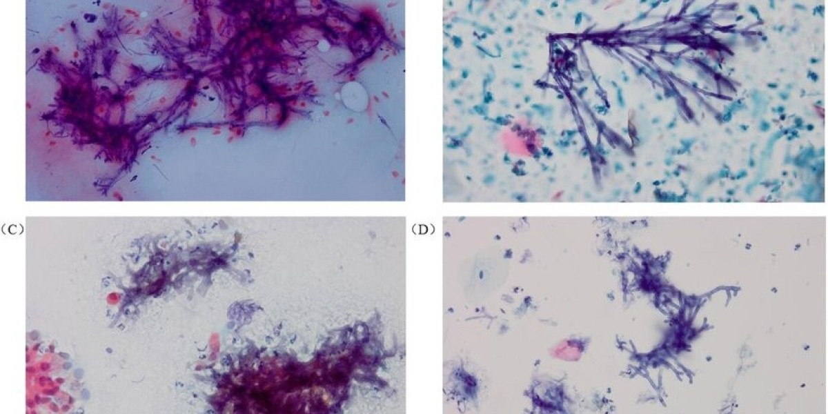 Philips Revolutionizes Cytology with 3D Imaging Technologies in 2024