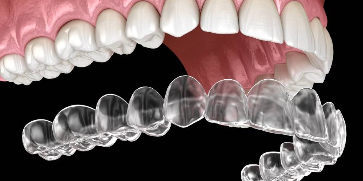 Invisalign: How It Works to Straighten Your Teeth